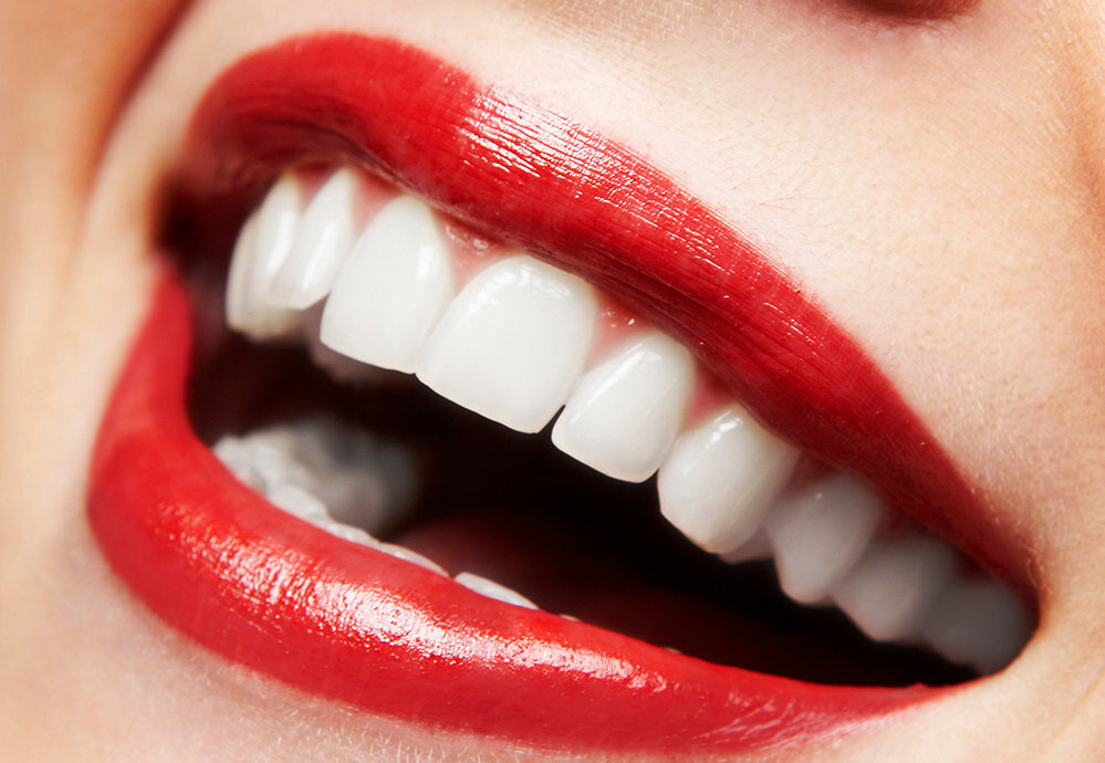     Отбеливание зубов дома: 5 способов, которые работают