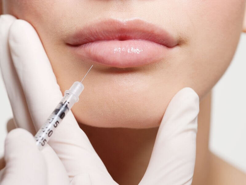 Types of fillers and their characteristics (part 1)