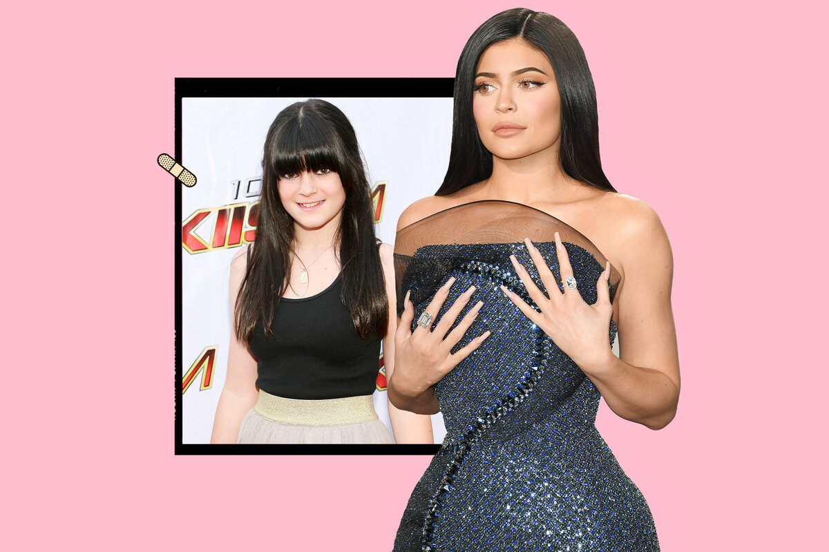     В 14 нос, а в 18 — грудь: звезды, которые очень рано сделали пластику