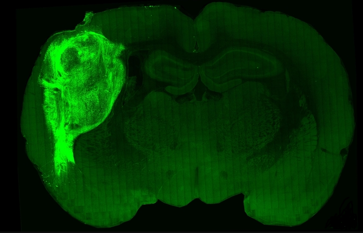 Трансплантированный человеческий органоид в мозге крысы