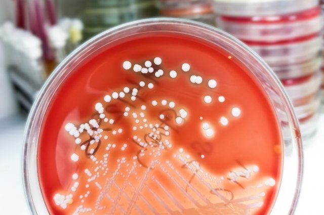    Что за бактерия стафилококк и чем опасна?