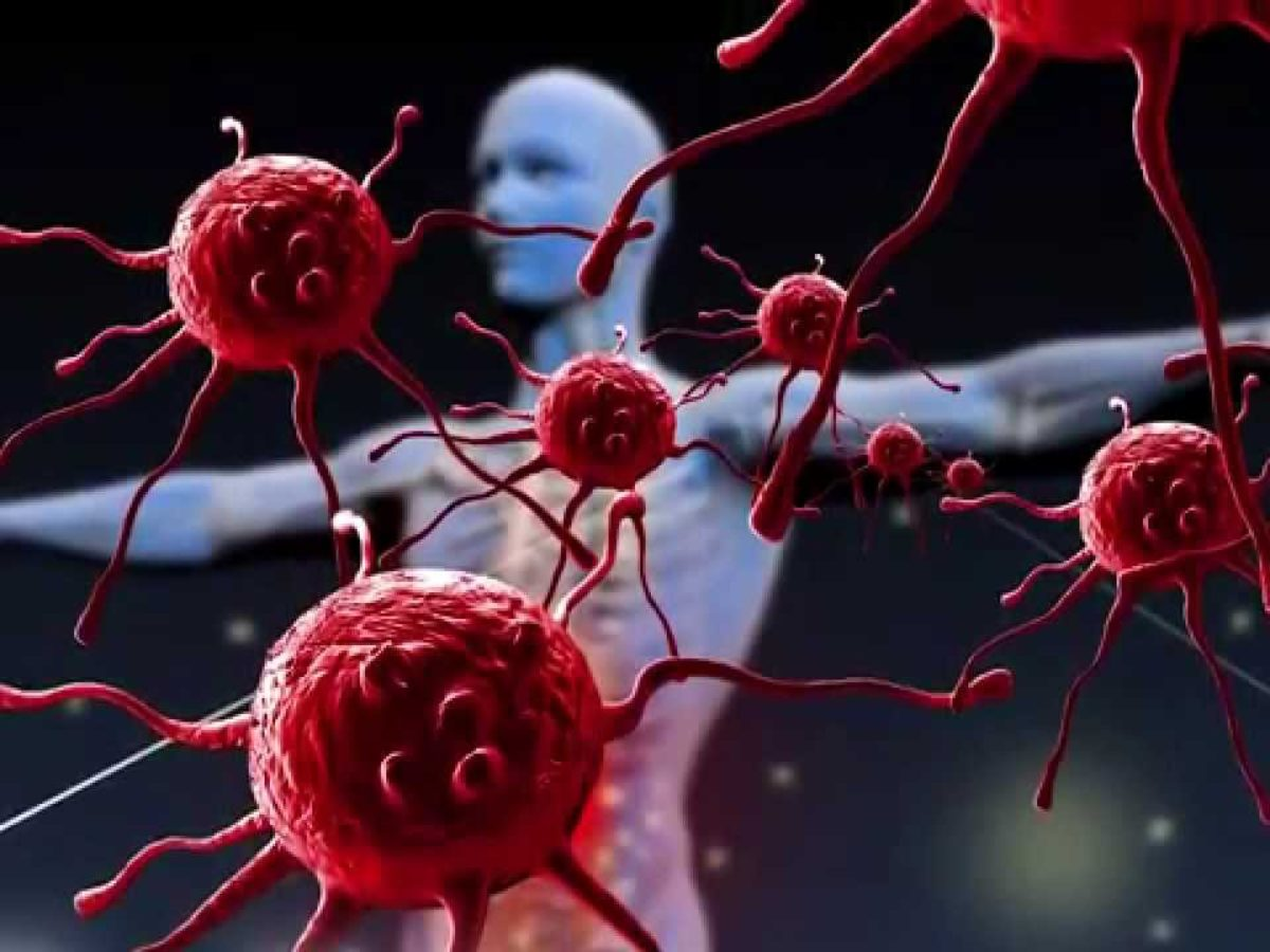 Аутоиммунные заболевания – виды, причины, лечение | Evolutis Clinic | Дзен