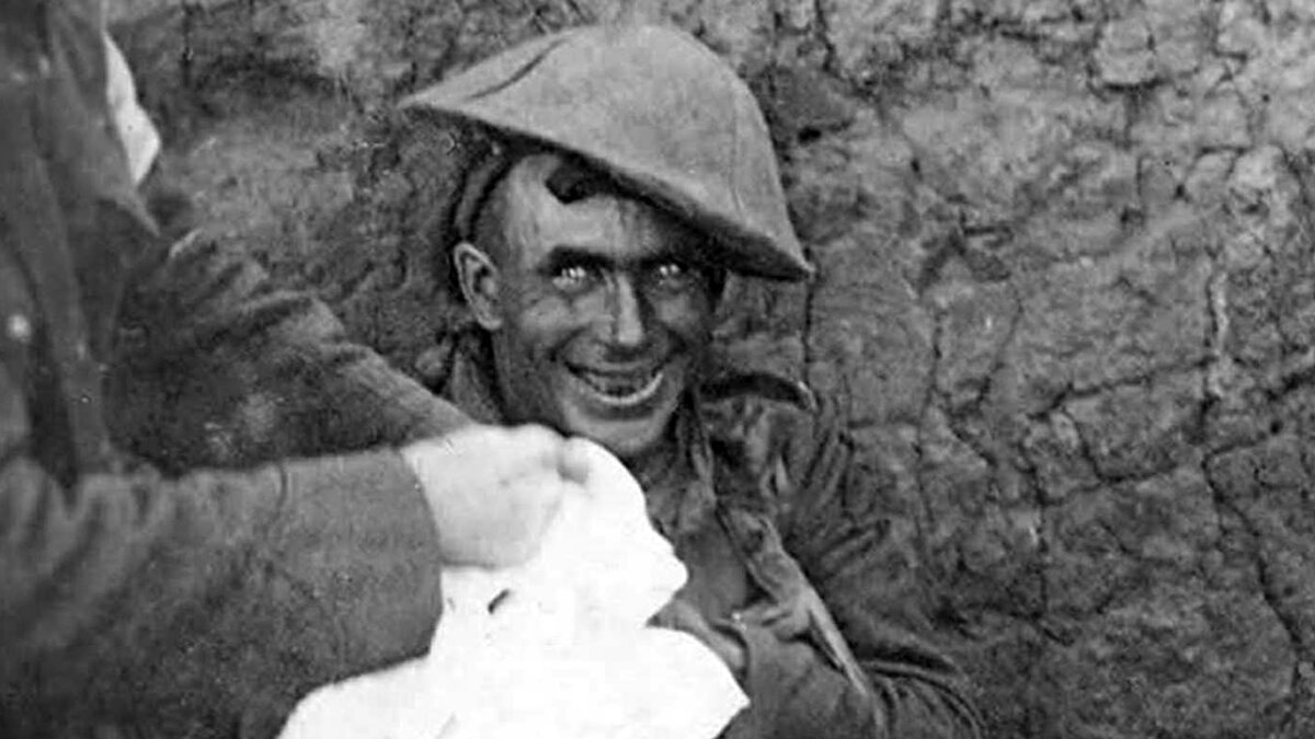 Контуженный солдат первой мировой войны