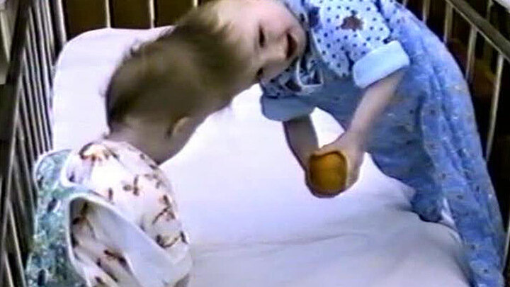 Виталия и Вилия до операции