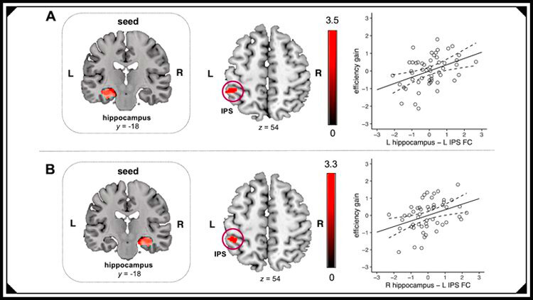 Функциональные цепи гиппокампа и темени предсказывают увеличение количества тренировок. Функциональная связь (А) левого и (Б) правого гиппокампа с левой внутрипариетальной бороздой (IPS) предсказывает обучение детей (повышение эффективности) в ответ на обучение чувству чисел. L = влево; R = вправо. Автор: Chang et al., JNeurosci 2022