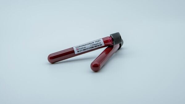   © Depositphotos.com / RECSTOCKFOOTAGE