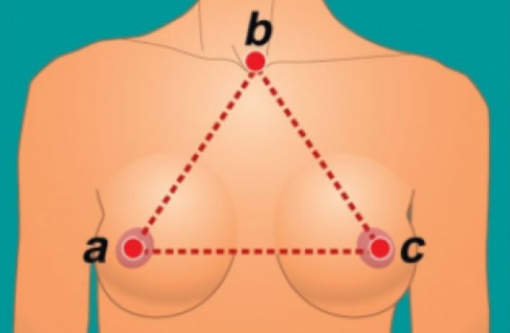 Центр Профессиональной Медицины - Плотная грудь: что вам нужно знать?