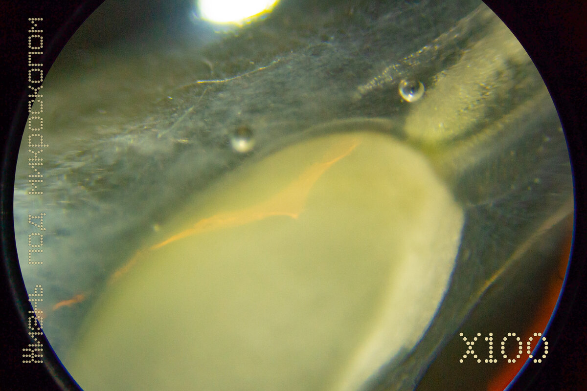 Очень маленькая семечка, все того же огурчика