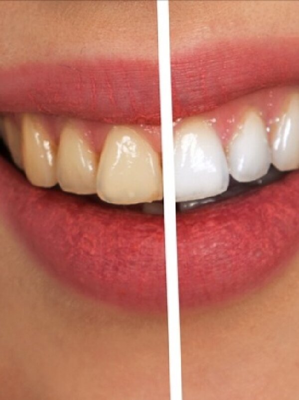 Source: https://pixabay.com/ru/illustrations/%D0%B7%D1%83%D0%B1-%D1%81%D1%82%D0%BE%D0%BC%D0%B0%D1%82%D0%BE%D0%BB%D0%BE%D0%B3%D0%B8%D1%87%D0%B5%D1%81%D0%BA%D0%B0%D1%8F-%D0%BF%D0%BE%D0%BC%D0%BE%D1%89%D1%8C-%D0%B1%D0%B5%D0%BB%D1%8B%D0%B9-2414909/