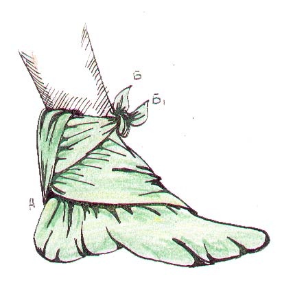        Повязка косынкой стопы. При перевязке пяточной области косынка кладется серединой на пятку, основание идет поперек подошвы, верхушка А лежит на задней поверхности голени. Концы Б и Б1 перекрещиваются на передней поверхности сустава и завязывают в области лодыжек, где сзади к ним прикрепляется и верхушка.