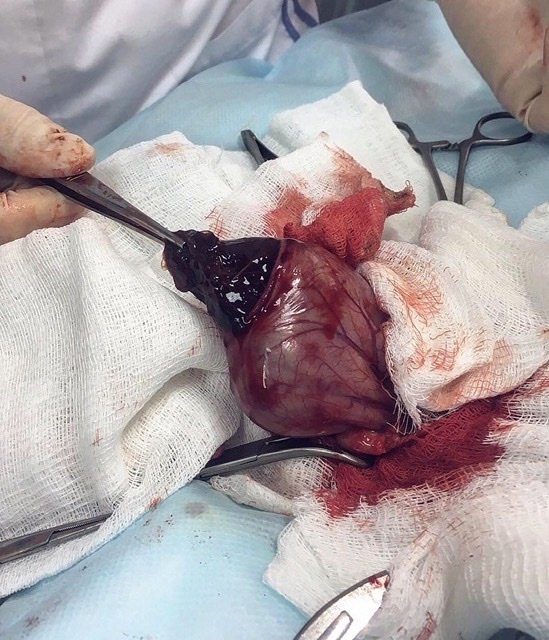 Фото 1 : пациент, собака , трихобезор полностью повторяет форму желудка . Как и сказано выше, для собак эта патология не совсем типична . 