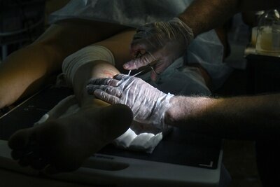    Врач оперирует раненого ©Константин Михальчевский РИА Новости