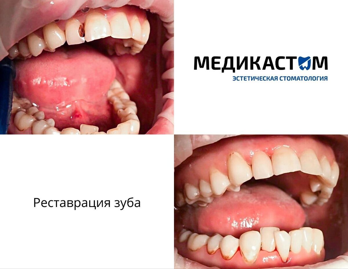 ДО/ПОСЛЕ