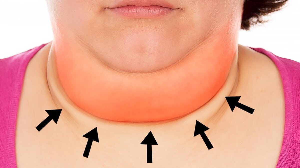 Источник: https://www.youtube.com/watch?v=ByiWEVQLMuI