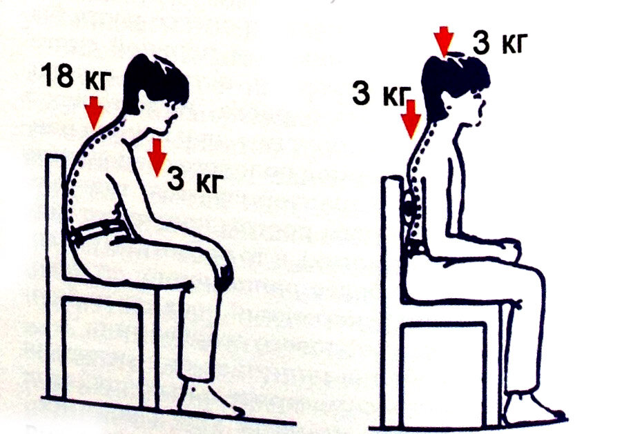 Начала сидеть голова. Влияние прикуса на осанку. Влияние прикуса на позвоночник и осанку. Нагрузка на позвоночник. Неправильная осанка сидя.
