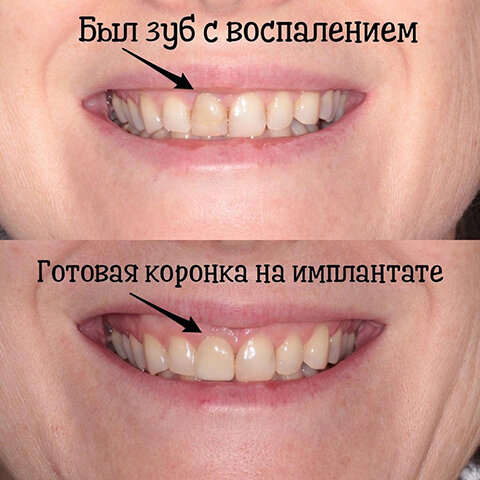 -1-2