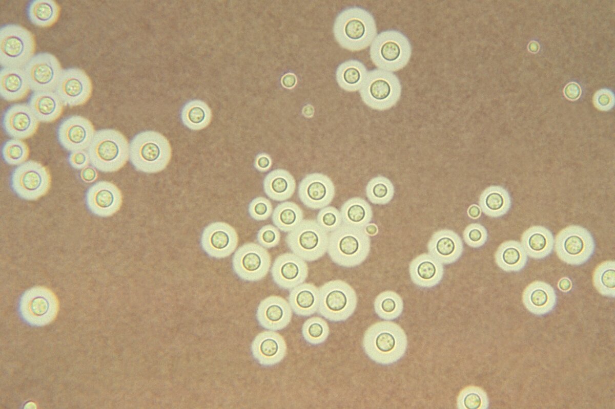     Грибок Cryptococcus neoformans "сжимается", чтобы проникнуть в мозг человека