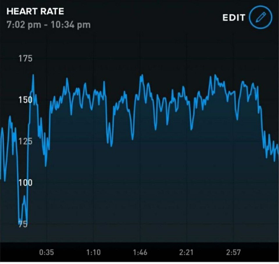     График изменения пульса Арины. Фото: соцсети