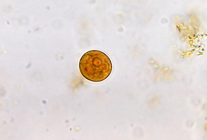 Entamoeba spp.