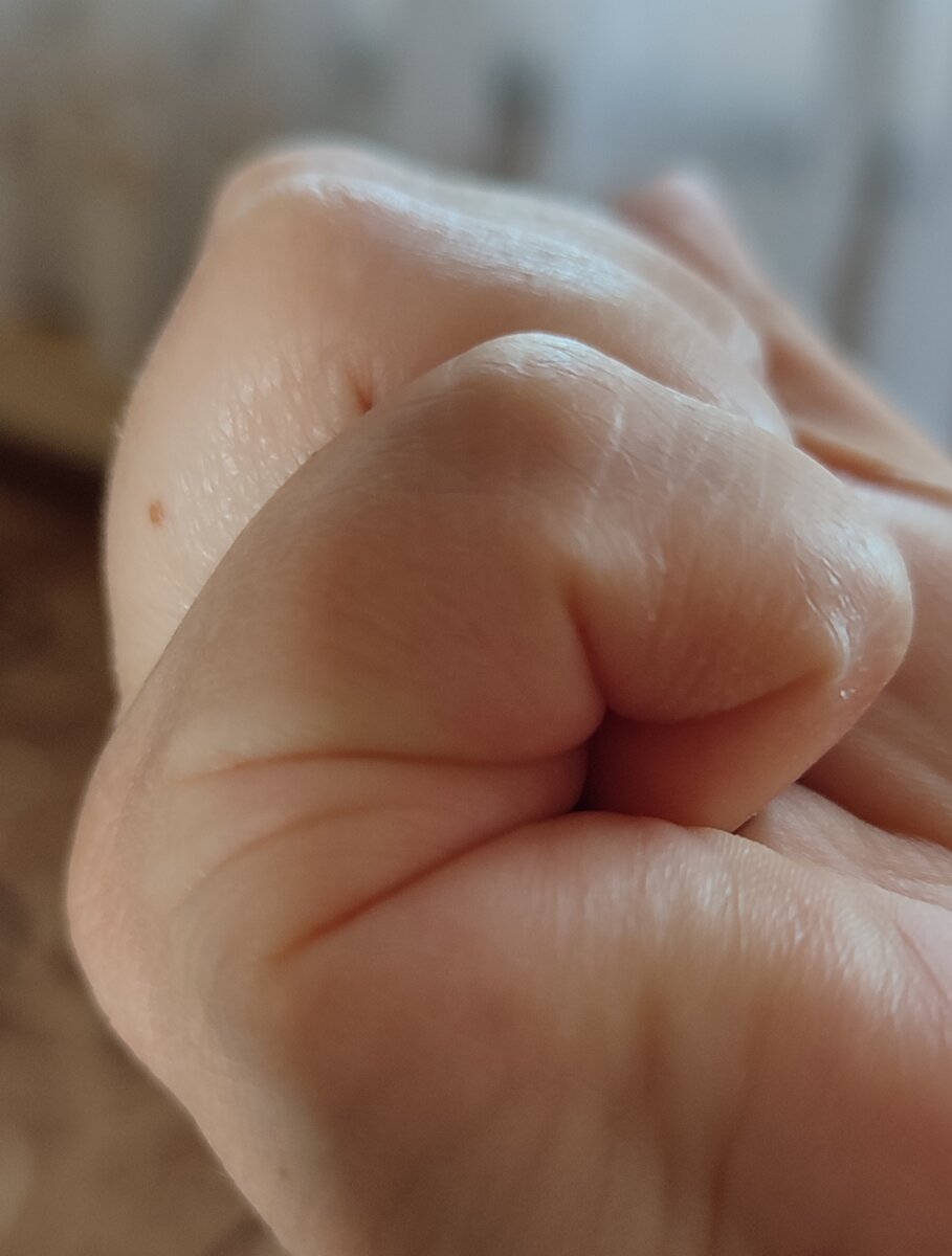 линия брака, одна между линией сердца и линией у основания мизинца. 