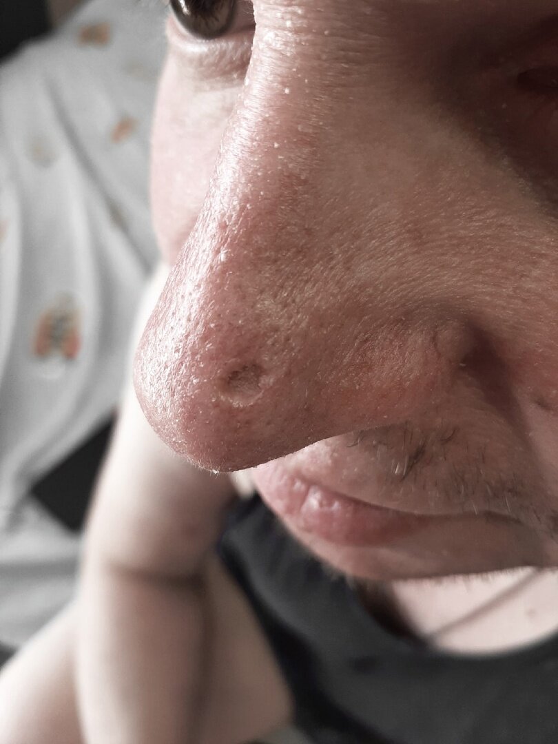 Реальное состояние "дыры"