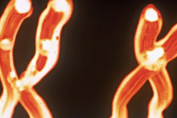     Многие мужчины с возрастом теряют Y-хромосомы: вот почему это смертельно опасно