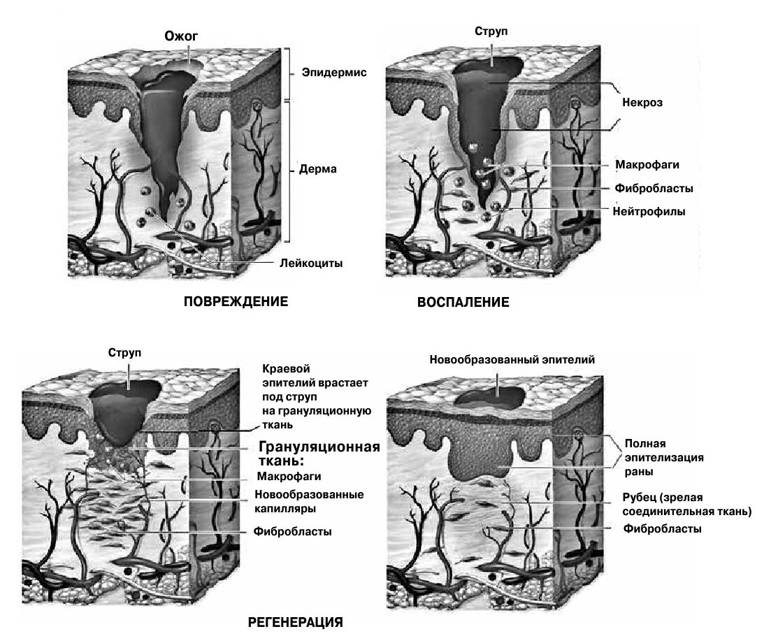 1. Этапы заживления раны