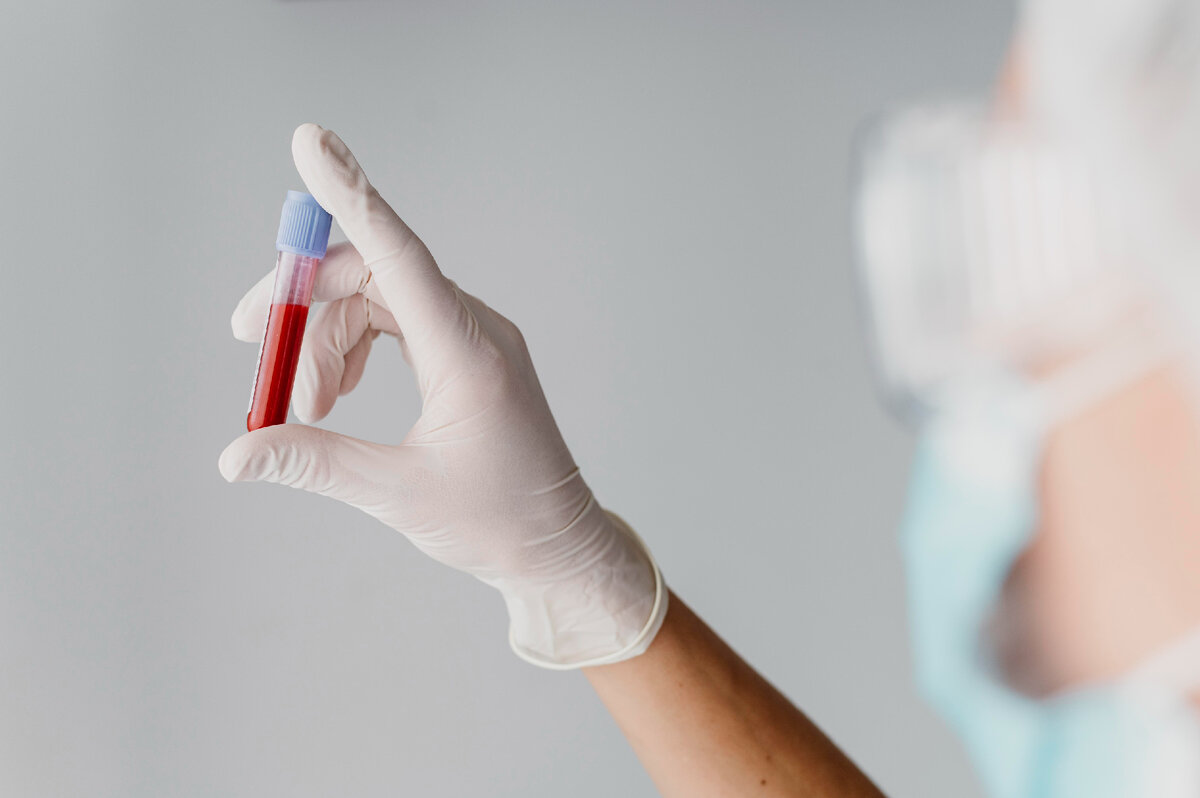 Изображение от <a href="https://ru.freepik.com/free-photo/back-view-doctor-holding-a-blood-sample_12336548.htm#query=%D0%BA%D1%80%D0%BE%D0%B2%D1%8C&position=1&from_view=search">Freepik</a>