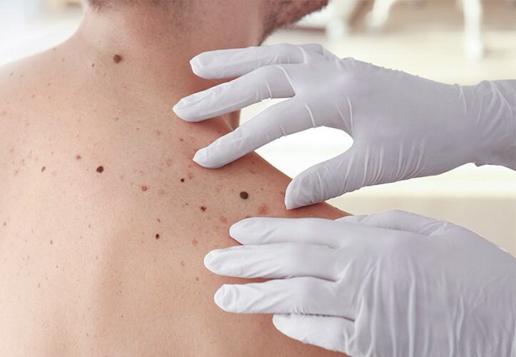 Дерматологи-онкологи ПИМУ