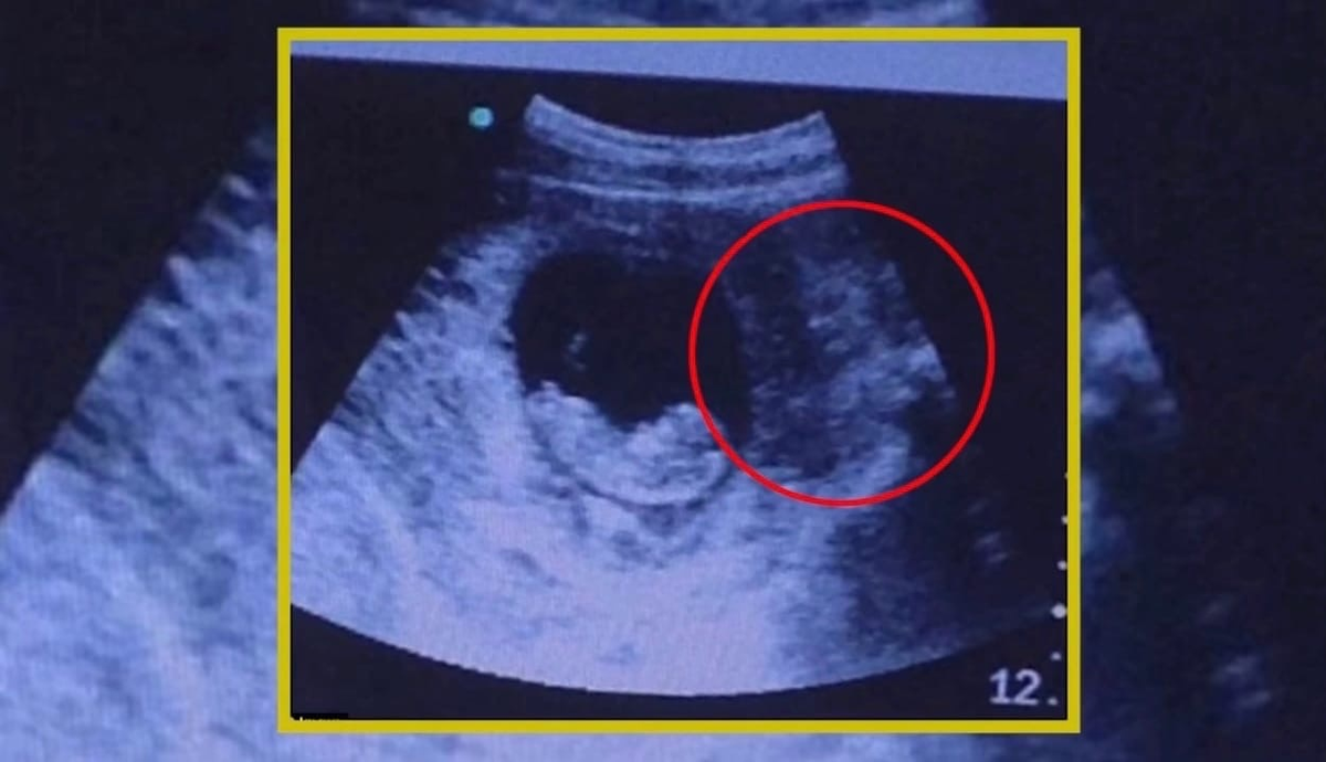 Отражение чувств