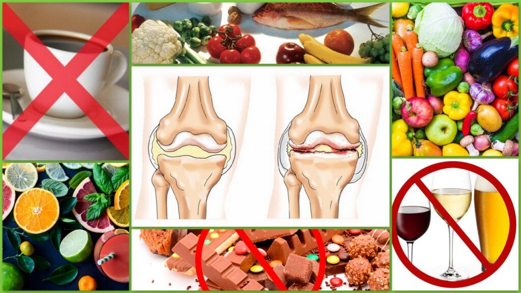 Артрит что можно что нельзя. Деформирующий остеоартроз питание. Пищевые продукты для суставов. Продукты для здоровых суставов. Продукты вредные для суставов.