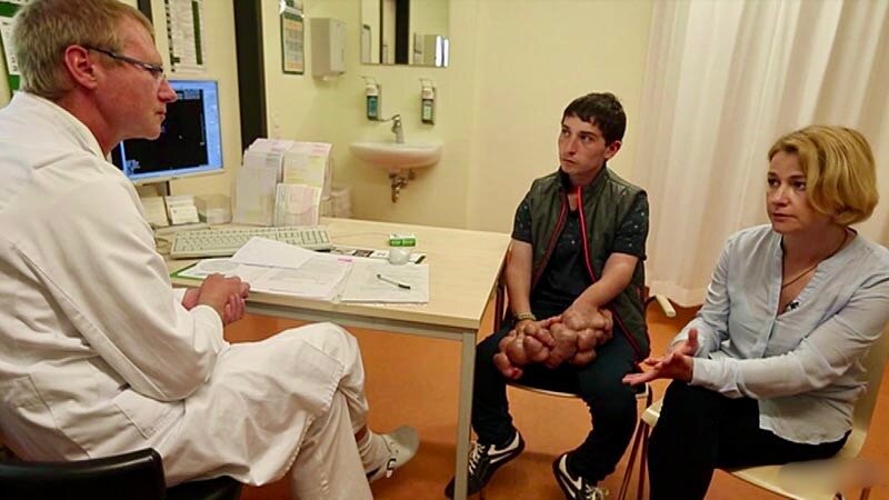 Иван павлюк после проекта с протезами