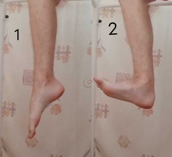 Функции передней большеберцовой мышцы.