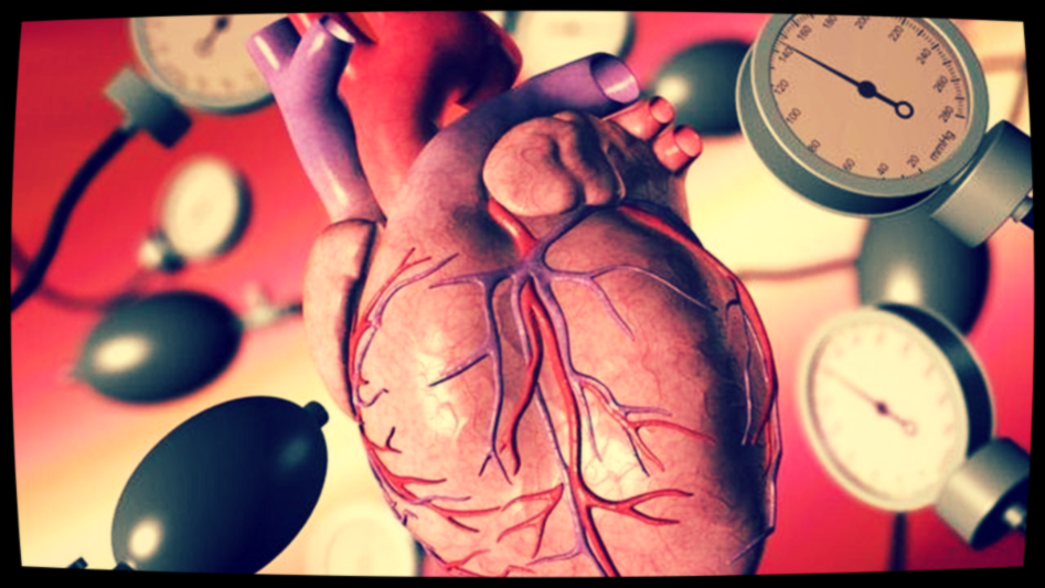 Приступ, который ведет к инсульту.