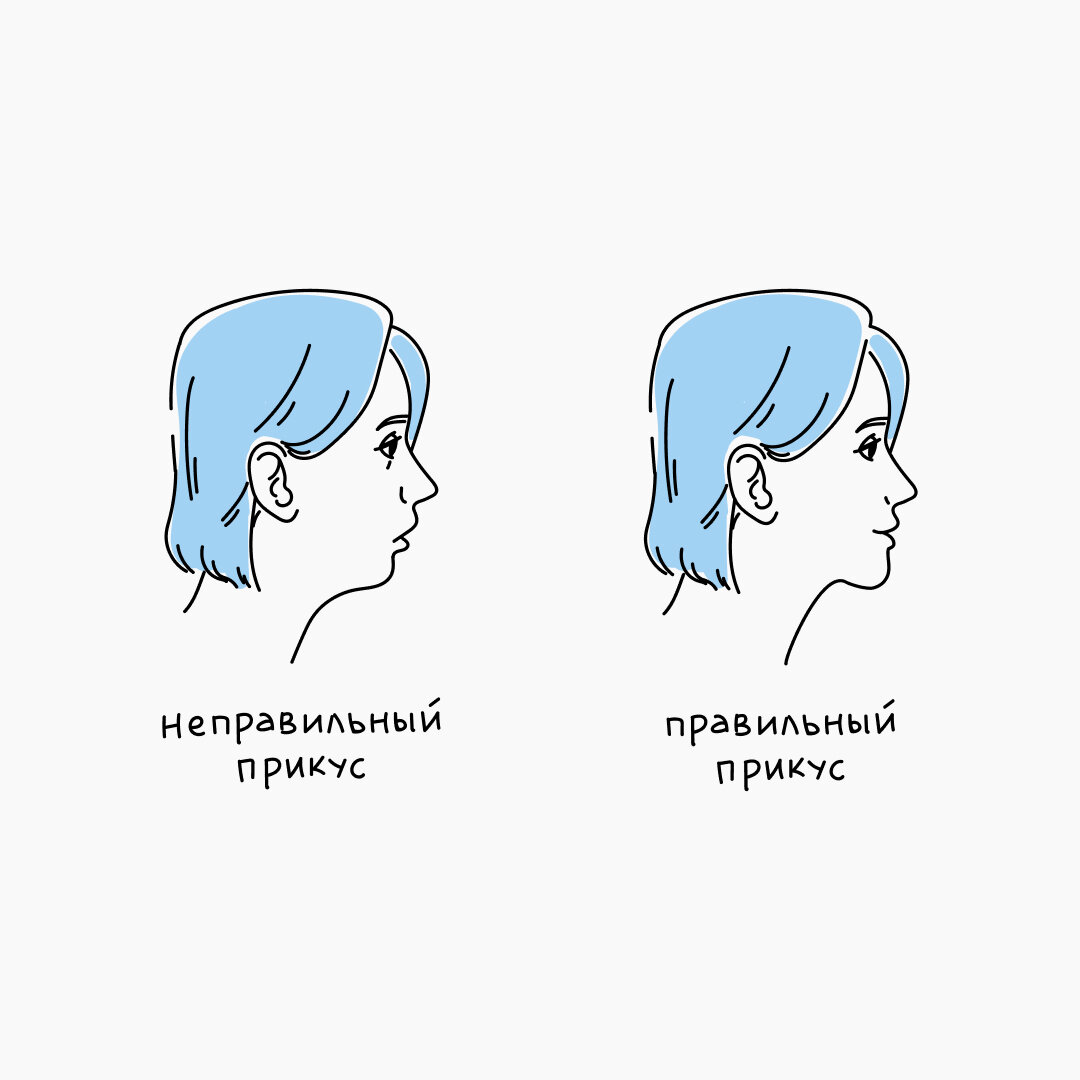 правильный и неправильный прикус. что значит неправильный прикус. что значит неправильный прикус. что значит неправильный прикус. правильный прикус вид сбоку.