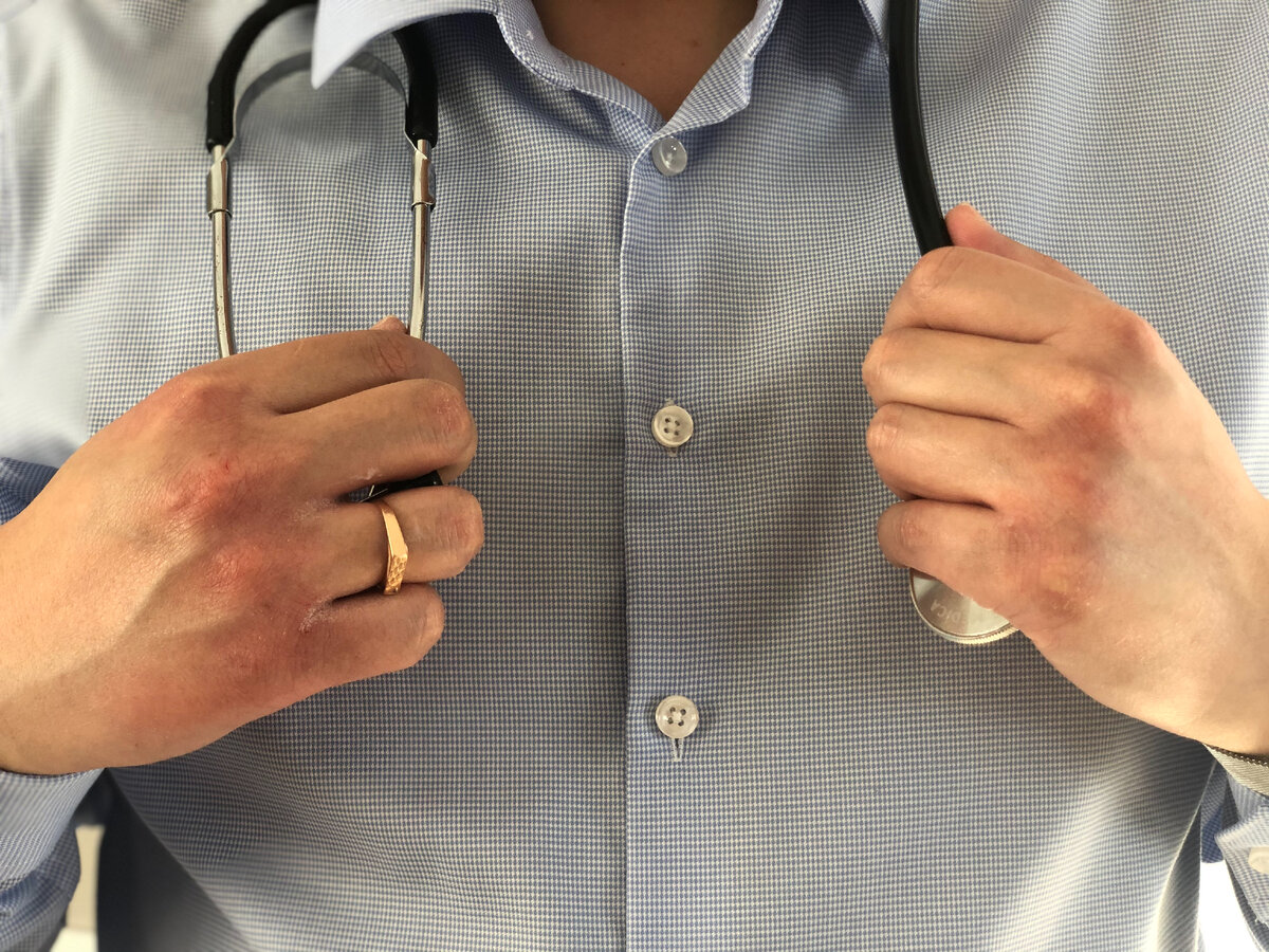 "Холодовая" аллергия тоже имеет место быть