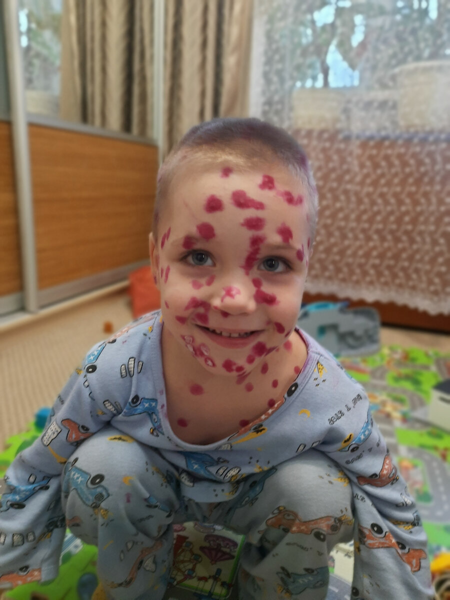 Пятнистое счастье моё!