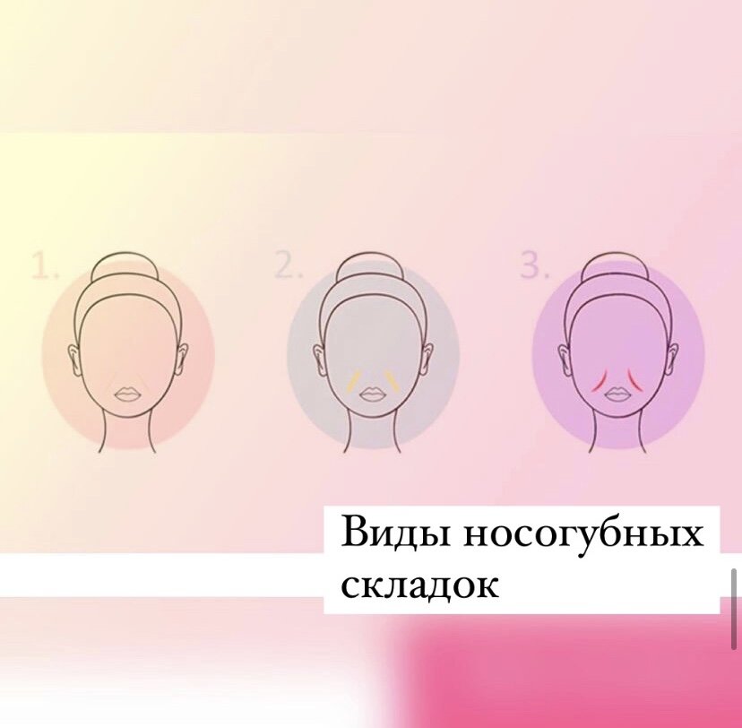 1-прямая складка, 2-выраженная складка и 3-градиентная складка.