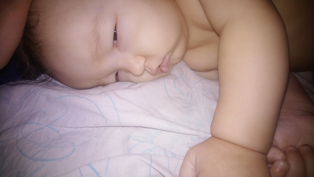 Отёк, из-за которого мы вызвали врача. 