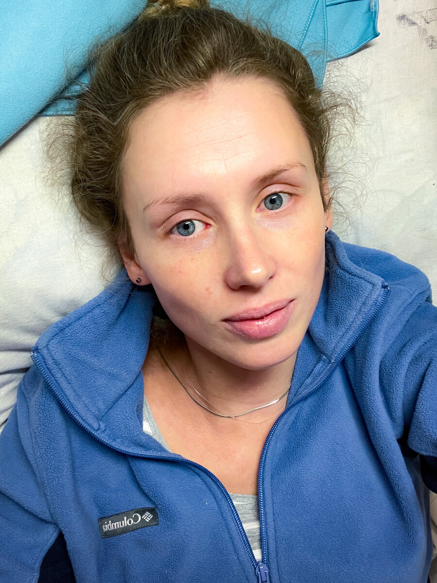 Когда родился с губами на пол лица)