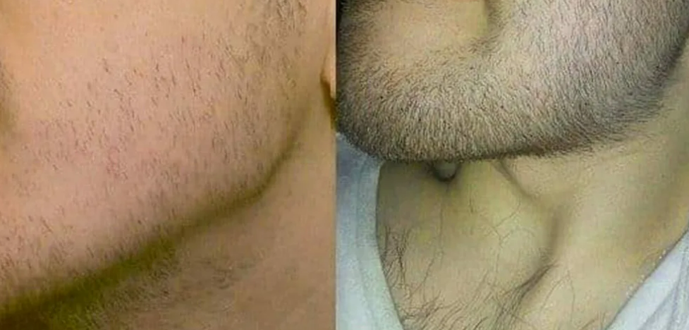 Фотография взята из источника heavybeard.com