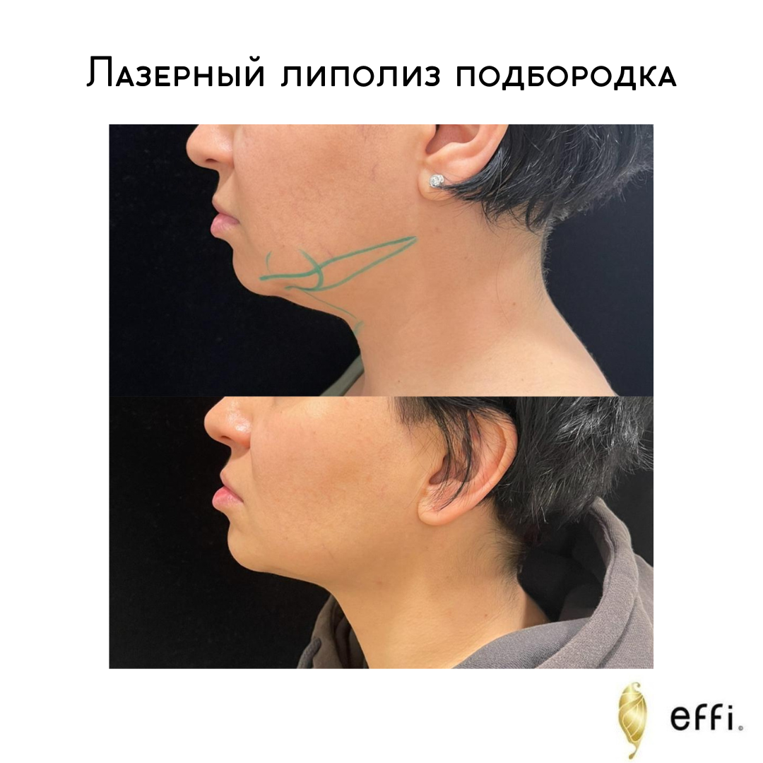 Клиника косметологии и пластической хирургии effi. Красноярск