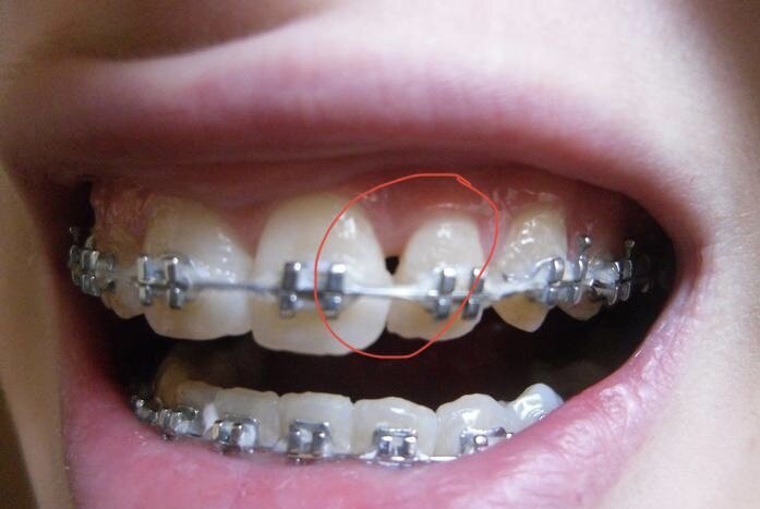 Черные треугольники. Не мои