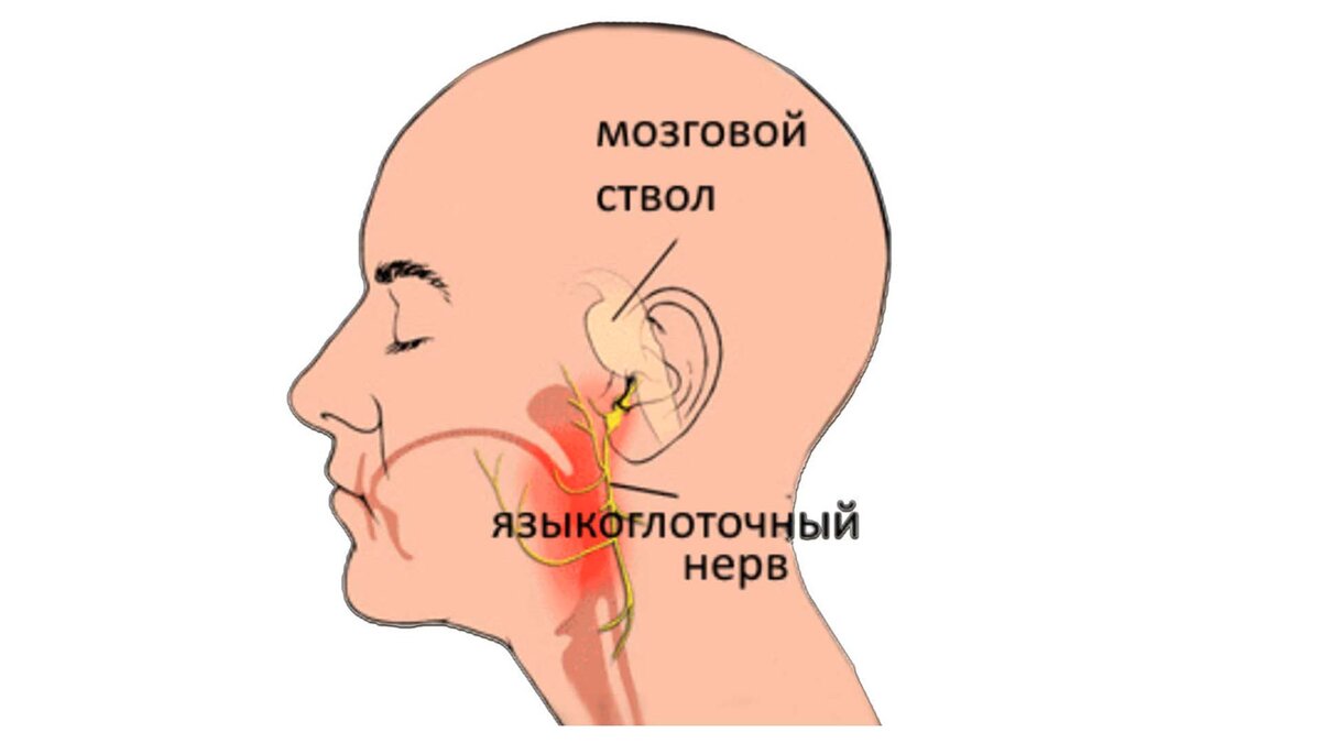 Языкоглоточный нерв | Первая Медицинская Клиника | Дзен