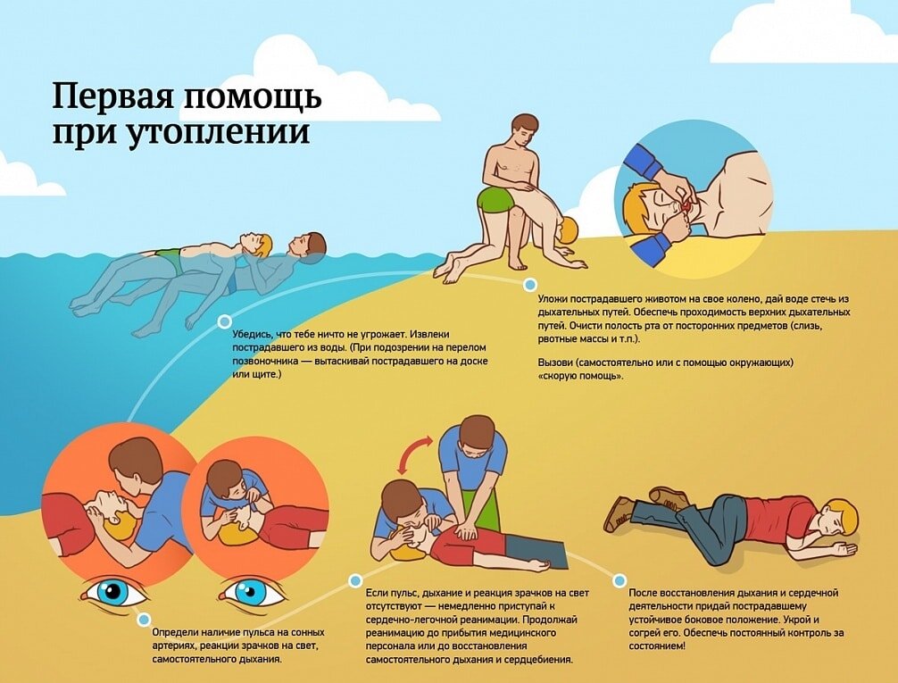 Алгоритм первой помощи при утоплении