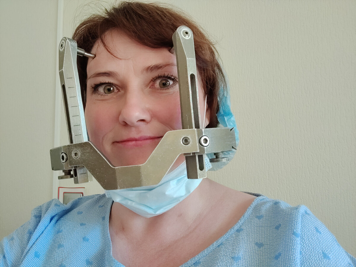 Подготовка к гамма-ножу