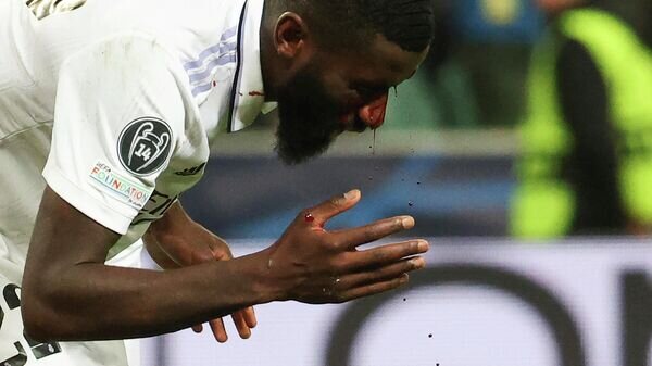   © AP / Michal Dyjuk