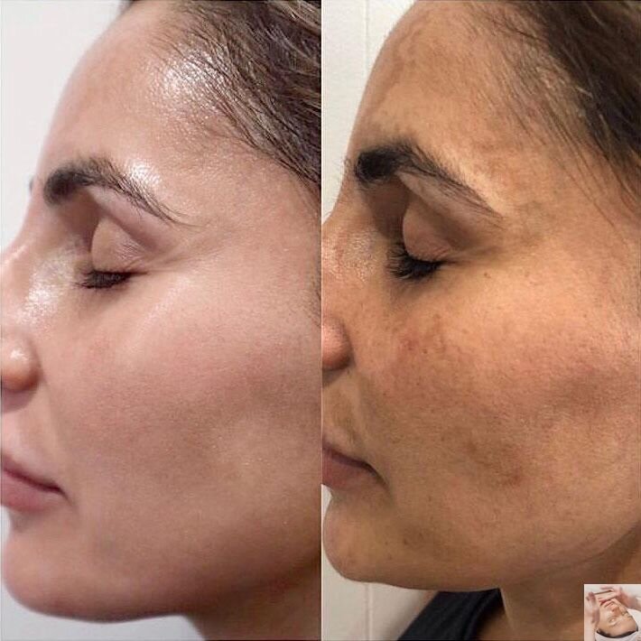 Ставьте лайки