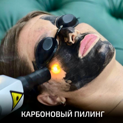 Процедура проведения карбонового пилинга специалистами студии "Forma"