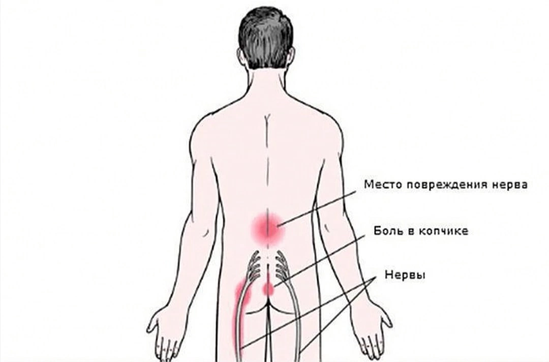 Почему на спине кашель